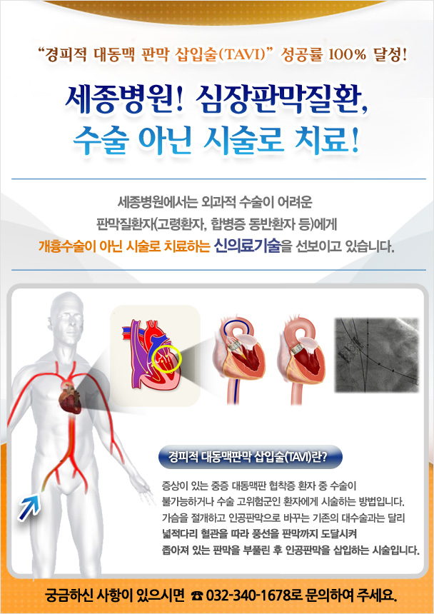 tavi안정성_web.jpg