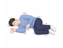 뇌전증
